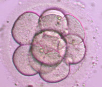 9-cell Grade I